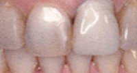Before and After Picture